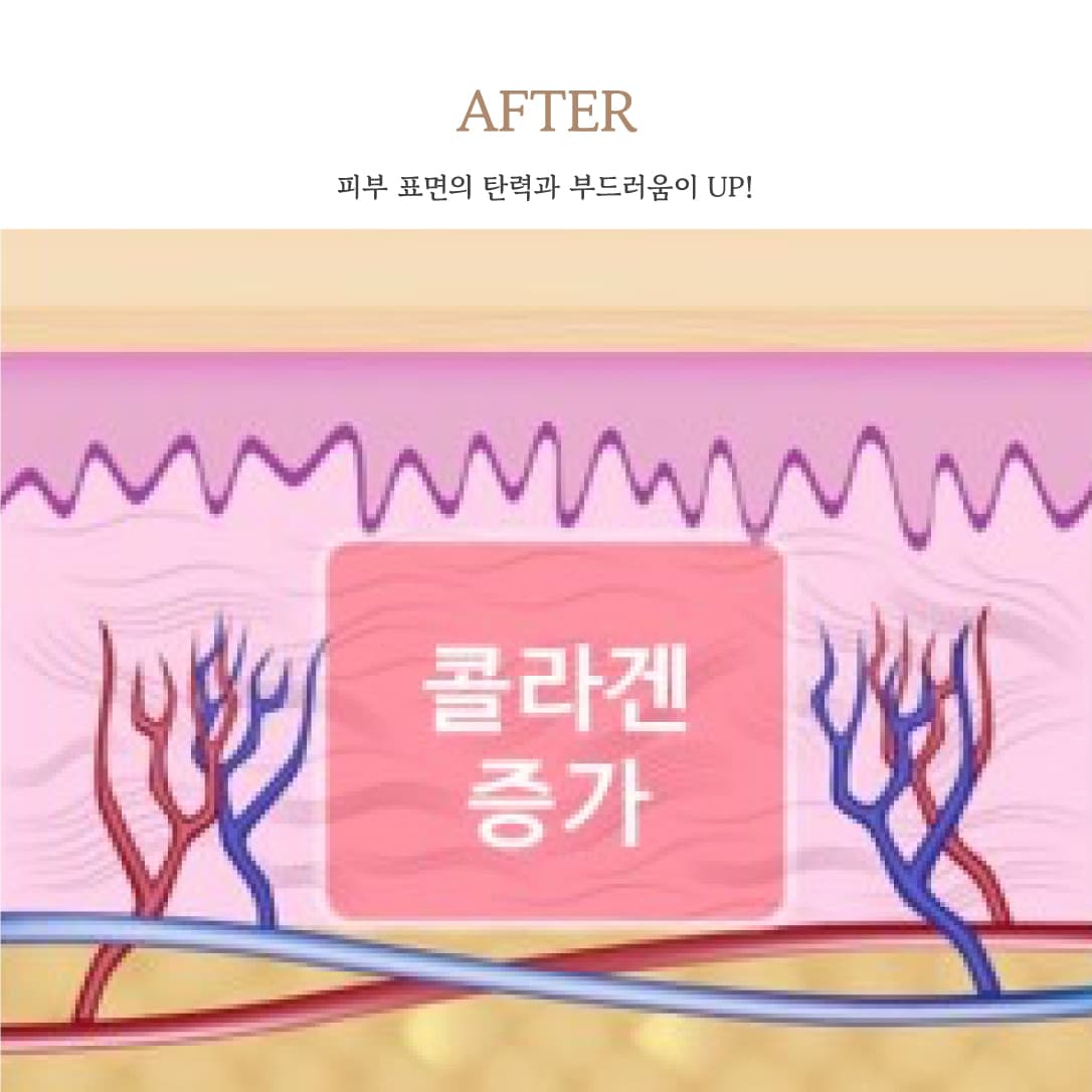 After treatment