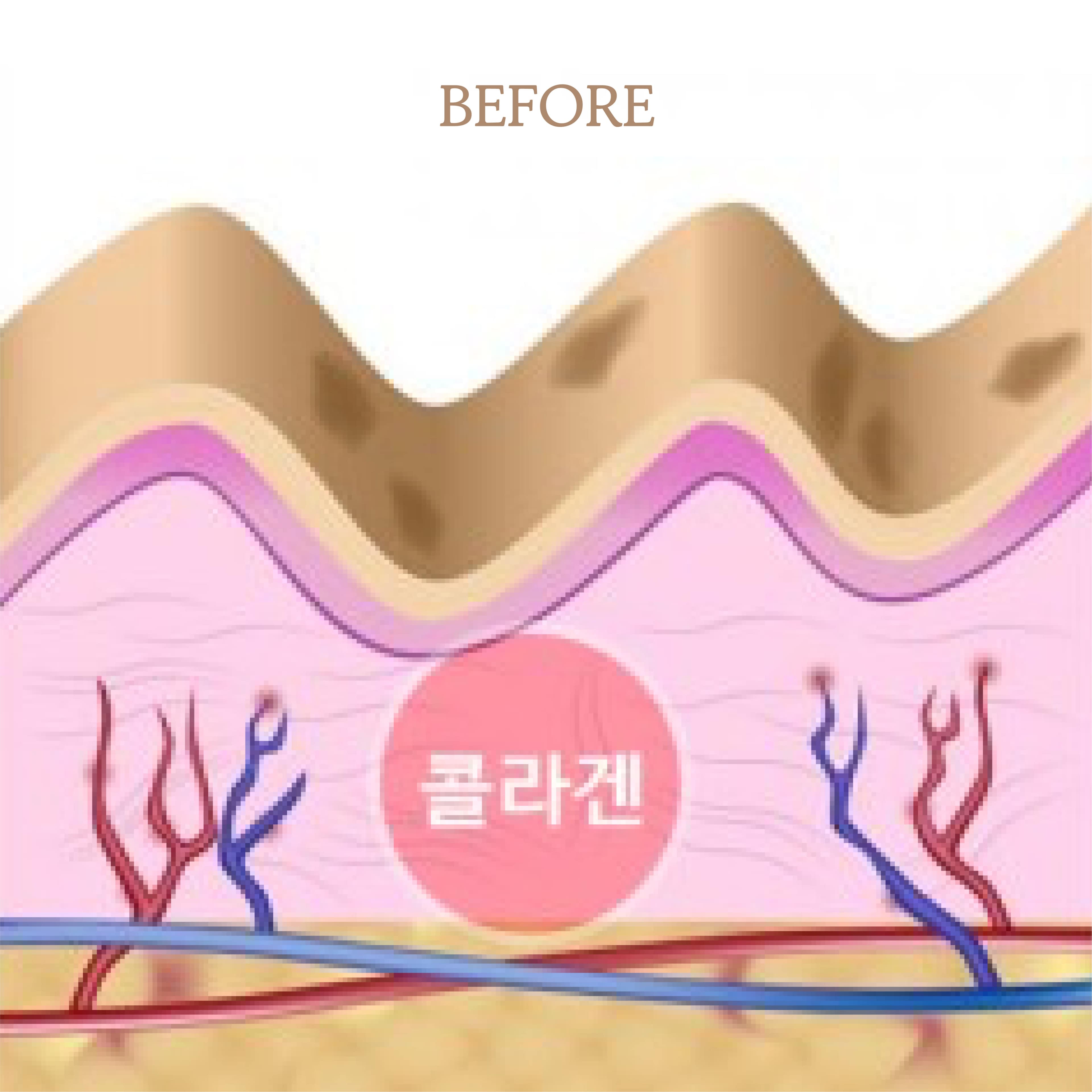 Before treatment