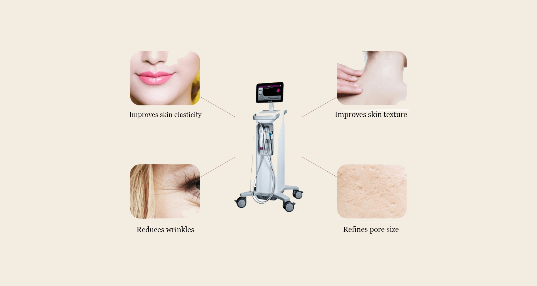 Thermage FLX Effects