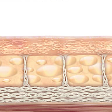 STEP. 3